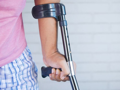 Is juridische hulp bij letselschade toegankelijk voor iedereen?